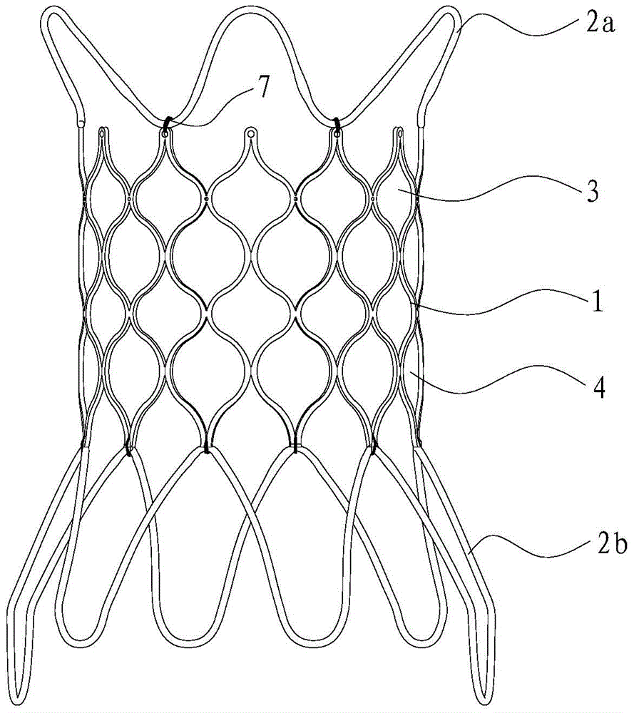 Safety improved pulmonary artery stent and pulmonary artery valve replacement device