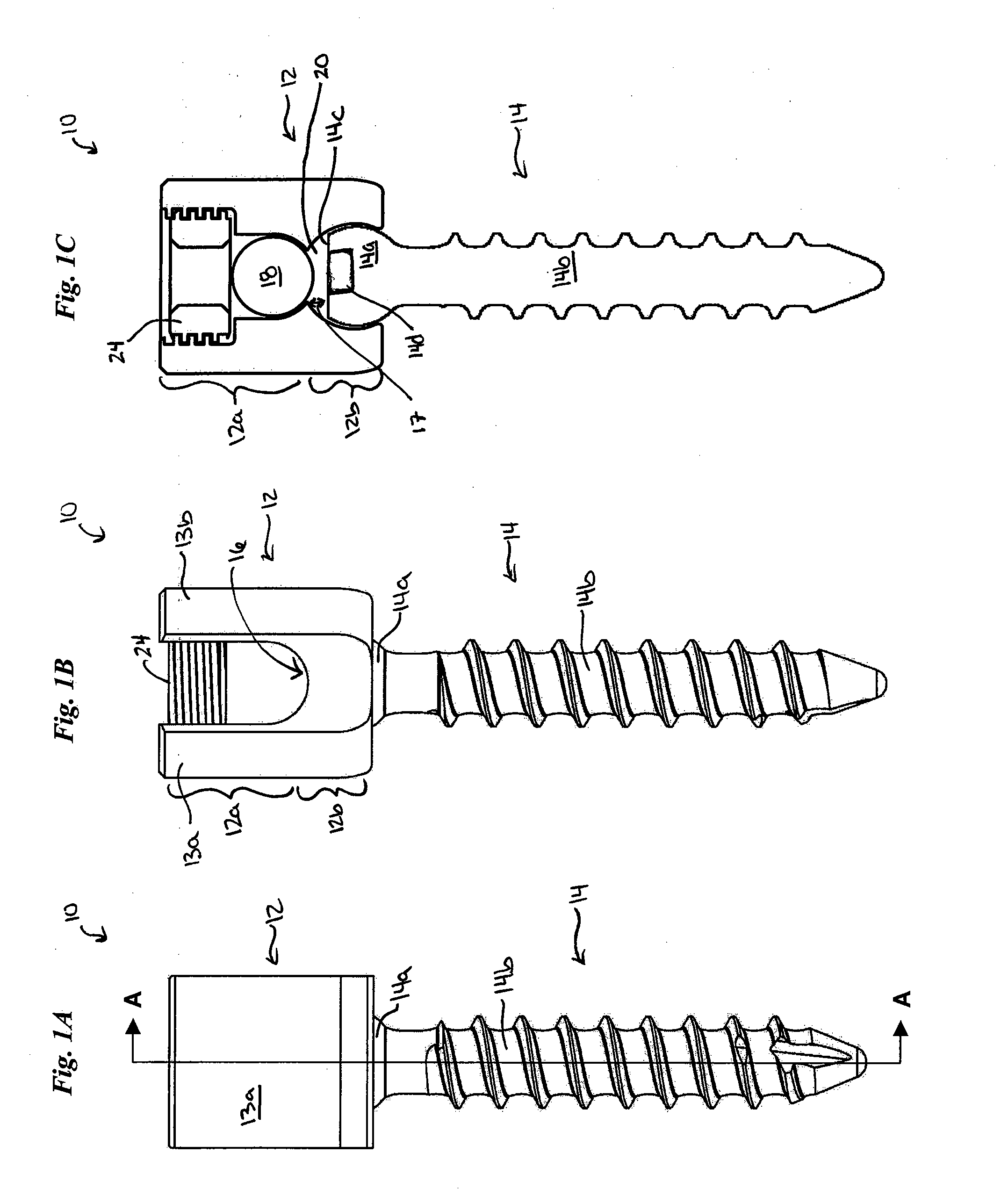 Anchoring systems and methods for correcting spinal deformities