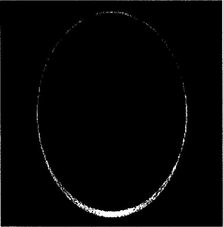 Method for removing Gibbs ring pseudo-image generated in MRI reconstruction process