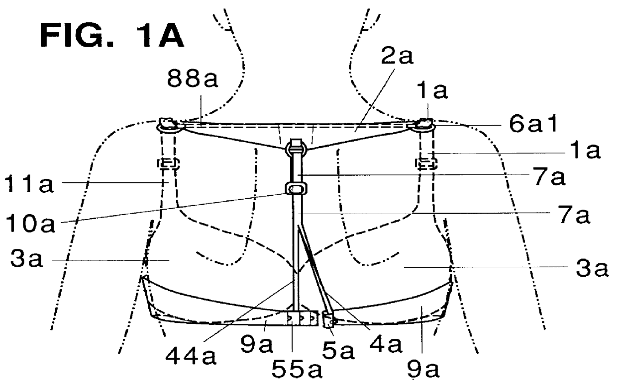 T-back breast support system garment