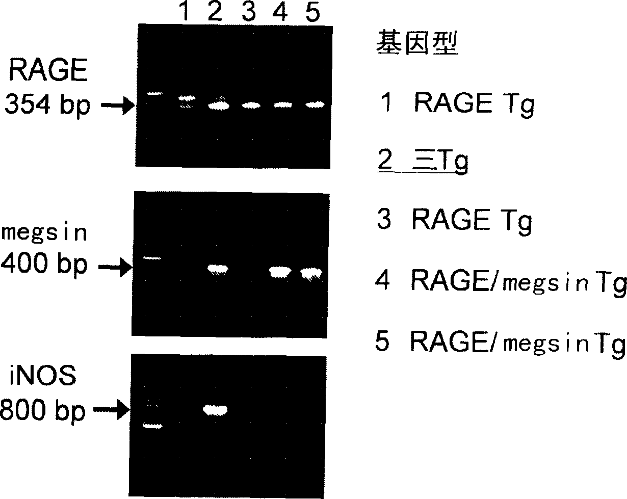 Disease model animal expressing MEGSIN/RAGE/iNOS and method of evaluating compound with the use of the animal