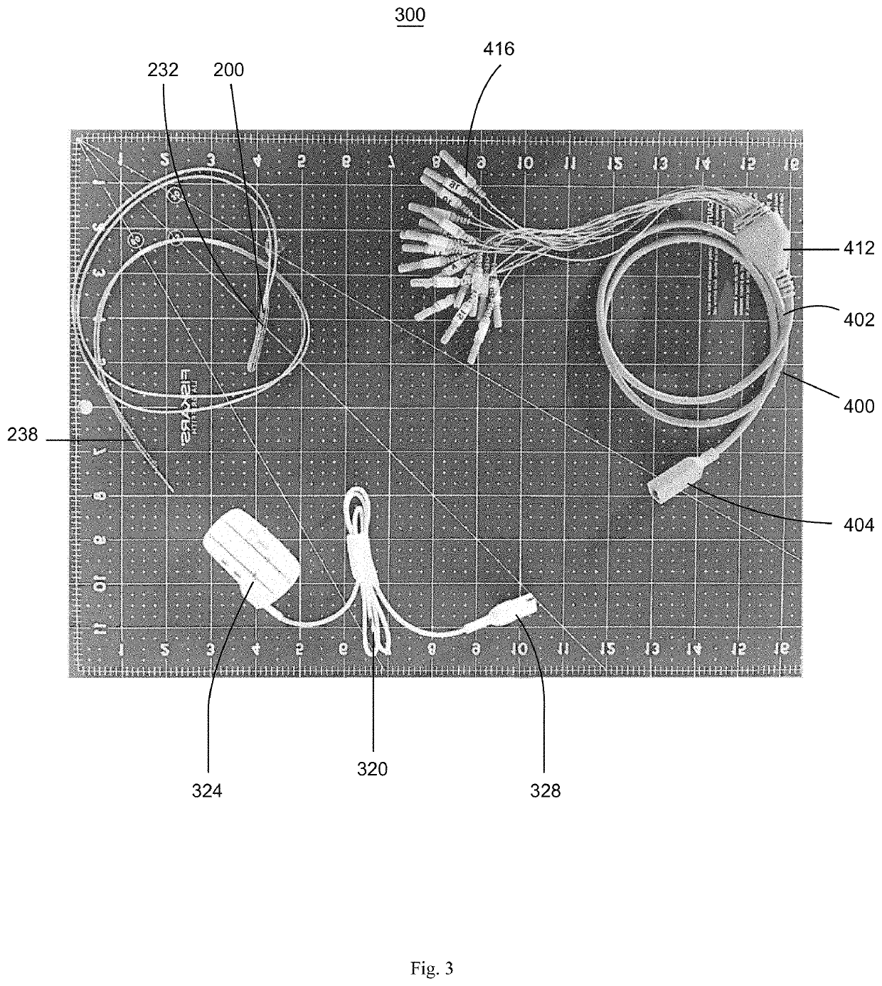 System And Related Method for Positioning of Surgically Implanted Neuro  Stimulation Device Electrodes