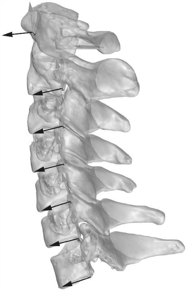Cone beam CT and image fusion combined cervical vertebra in-vivo three-dimensional motion analysis method