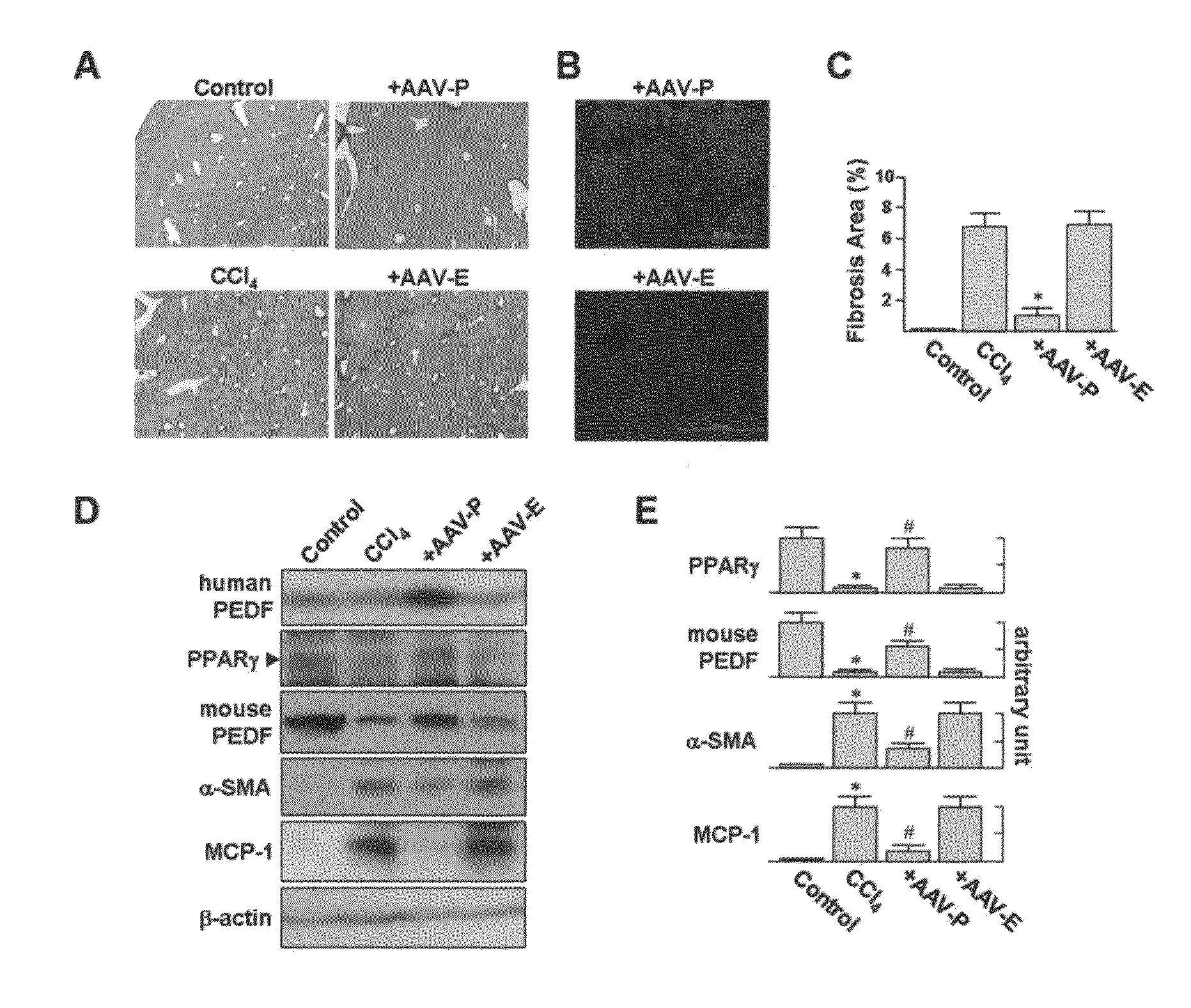 Use of PEDF-Derived Polypeptides for Treating Liver Cirrhosis