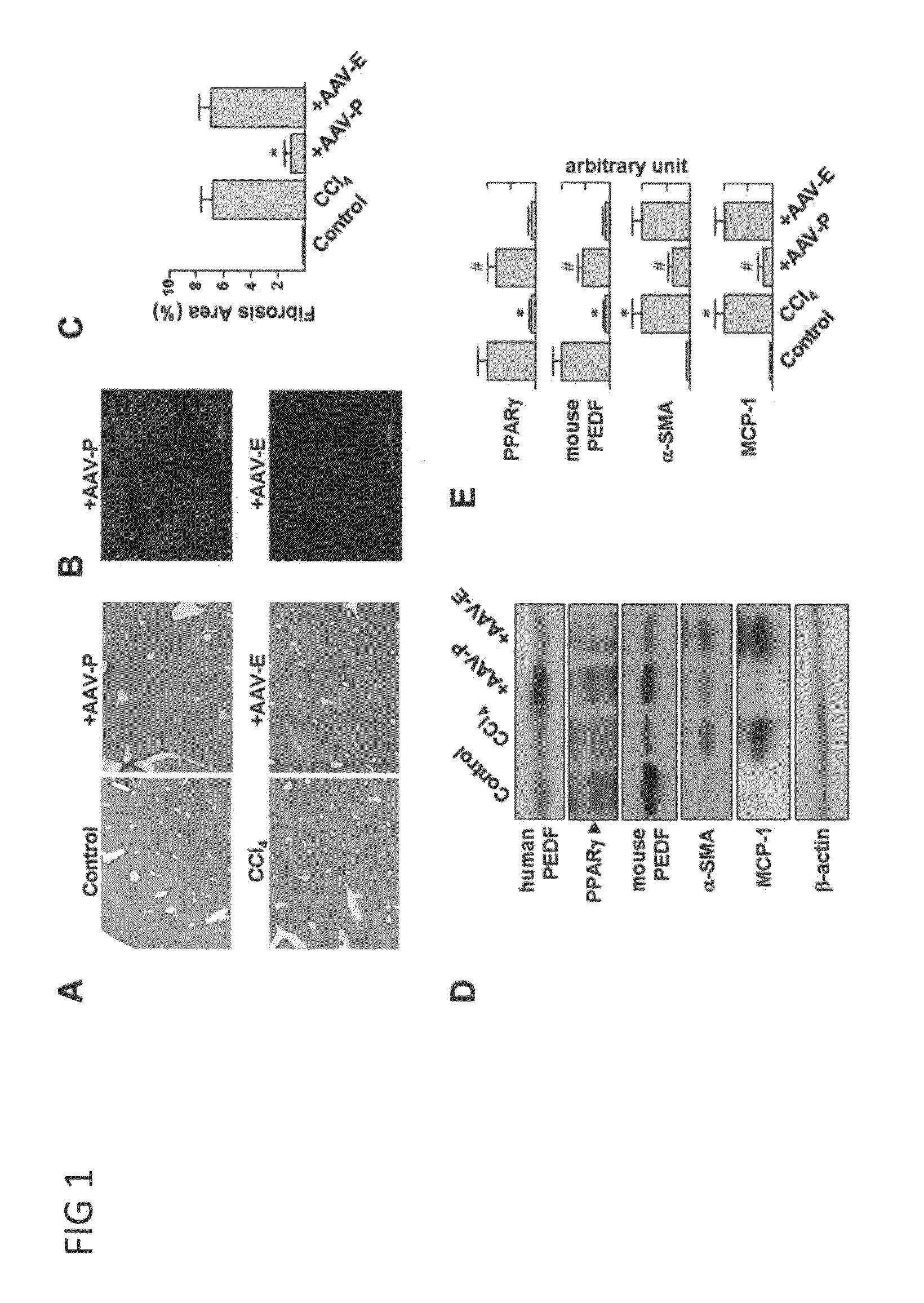 Use of PEDF-Derived Polypeptides for Treating Liver Cirrhosis