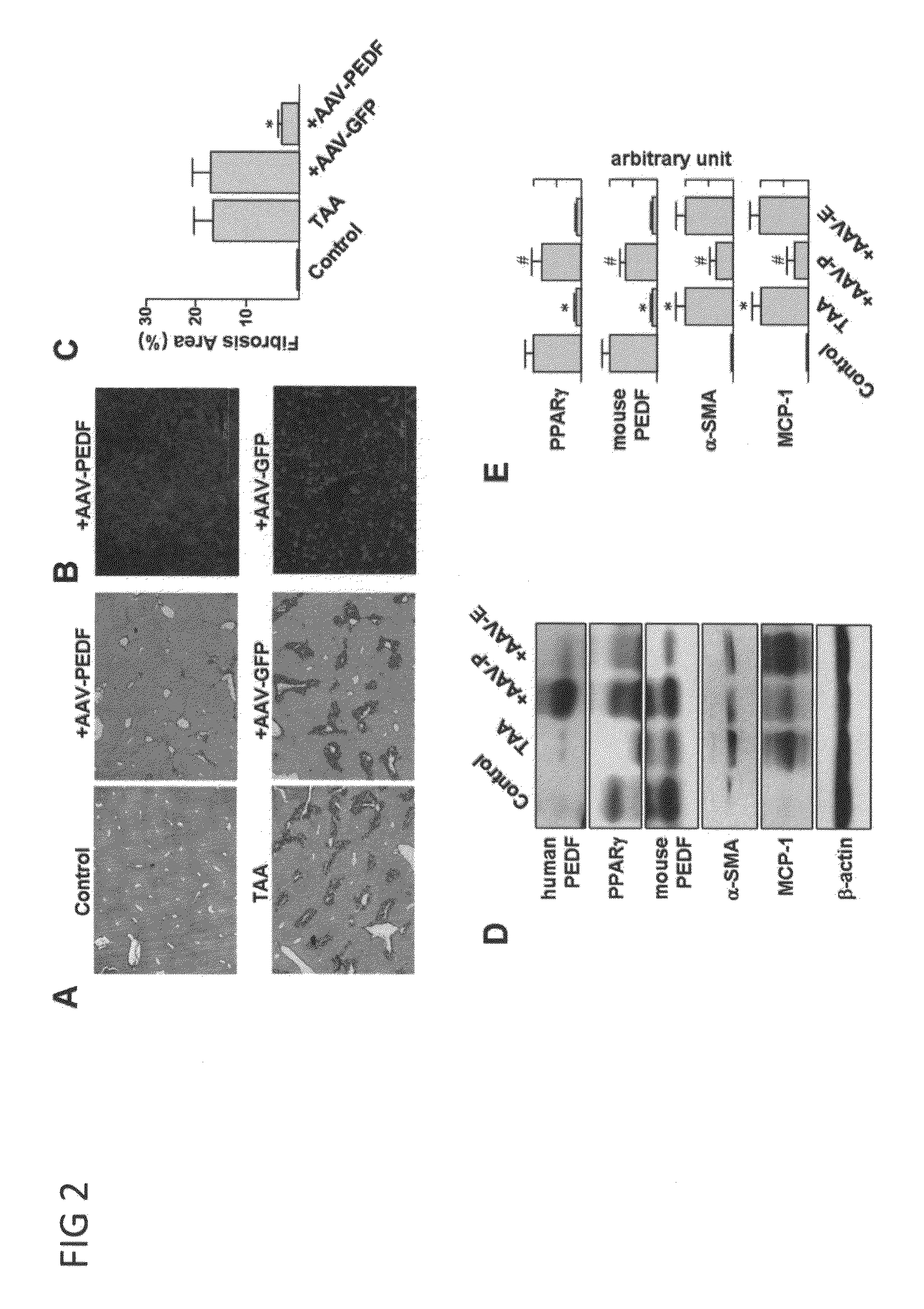 Use of PEDF-Derived Polypeptides for Treating Liver Cirrhosis