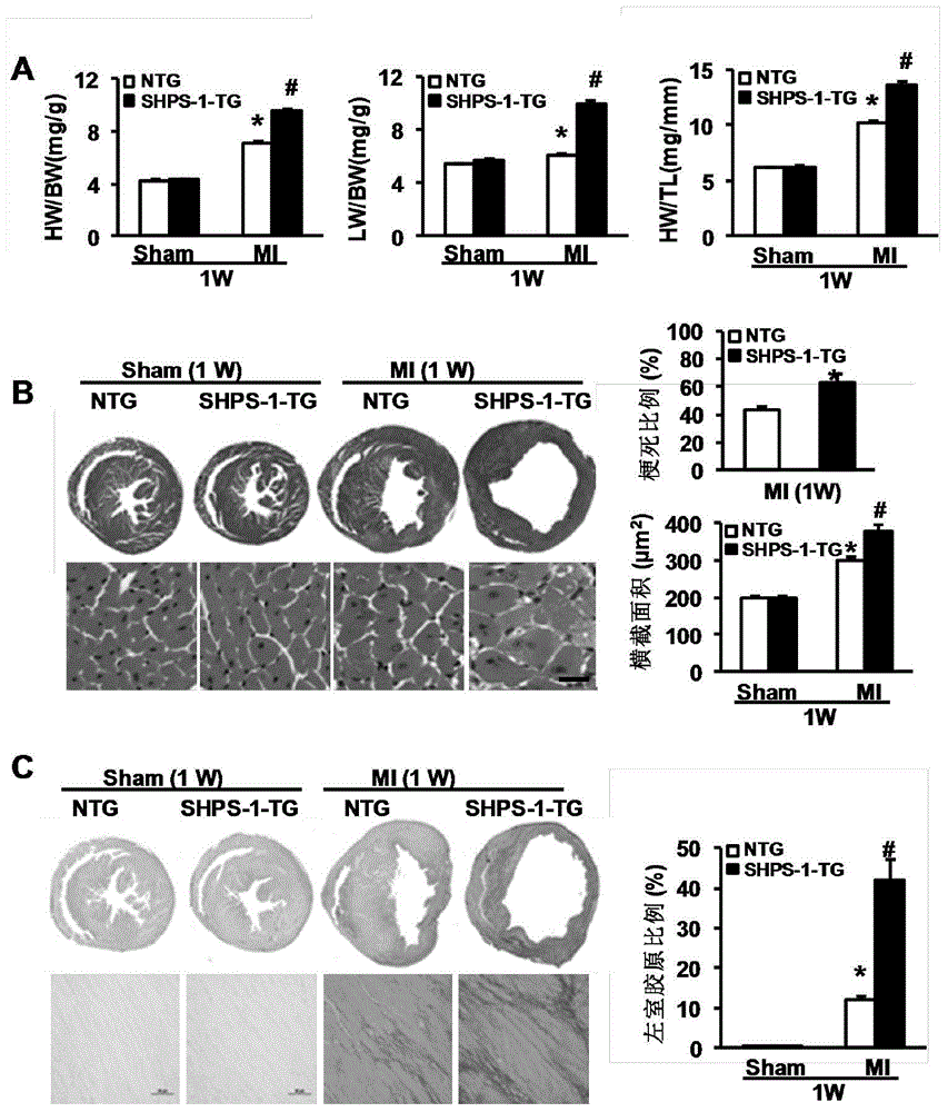 Application of Signal Regulatory Protein α (shsp-1) Gene in Myocardial Infarction