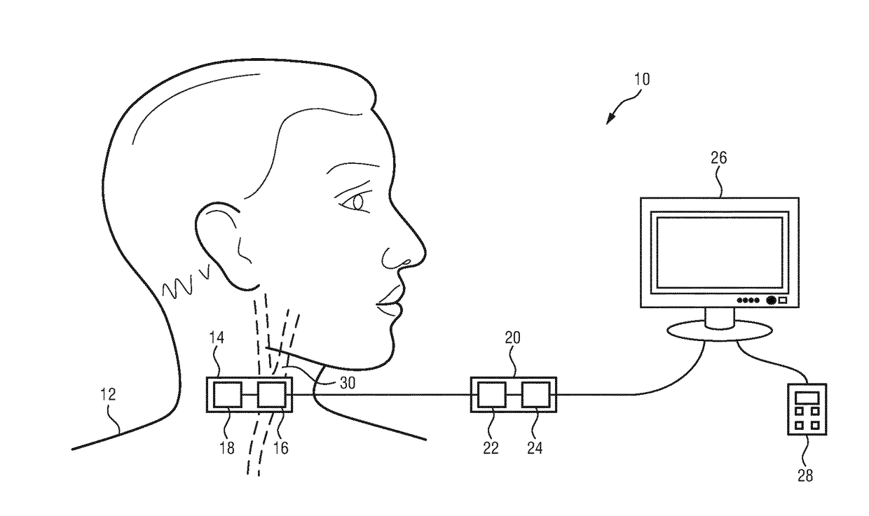 Monitoring apparatus for monitoring blood pressure of a subject