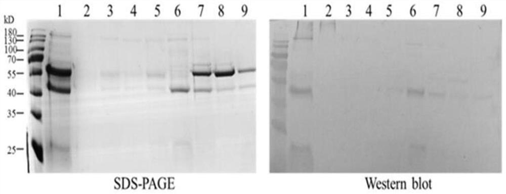 A kind of anti-ca125 nanobody 5d2 and its application