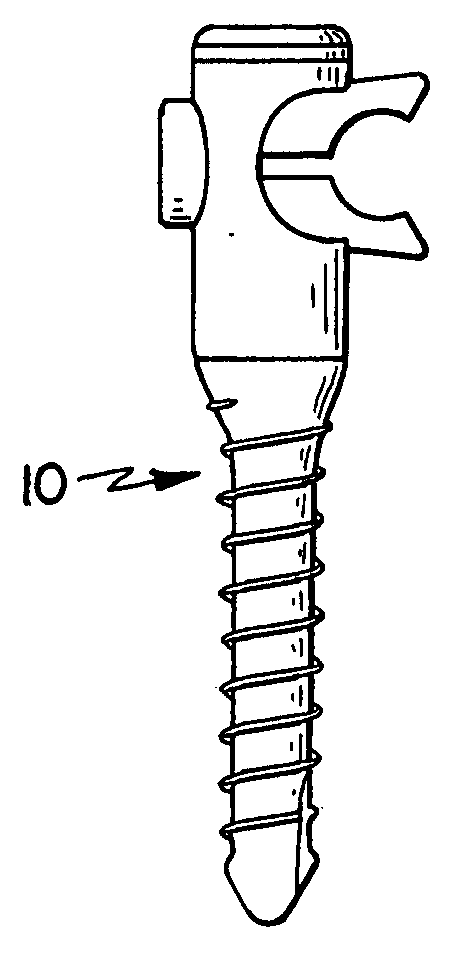 Screw sleeve made of polyetheretherketone (PEEK) for augmentation of bone screw insertion in osteoporotic or revision lumbar spine instrumentation