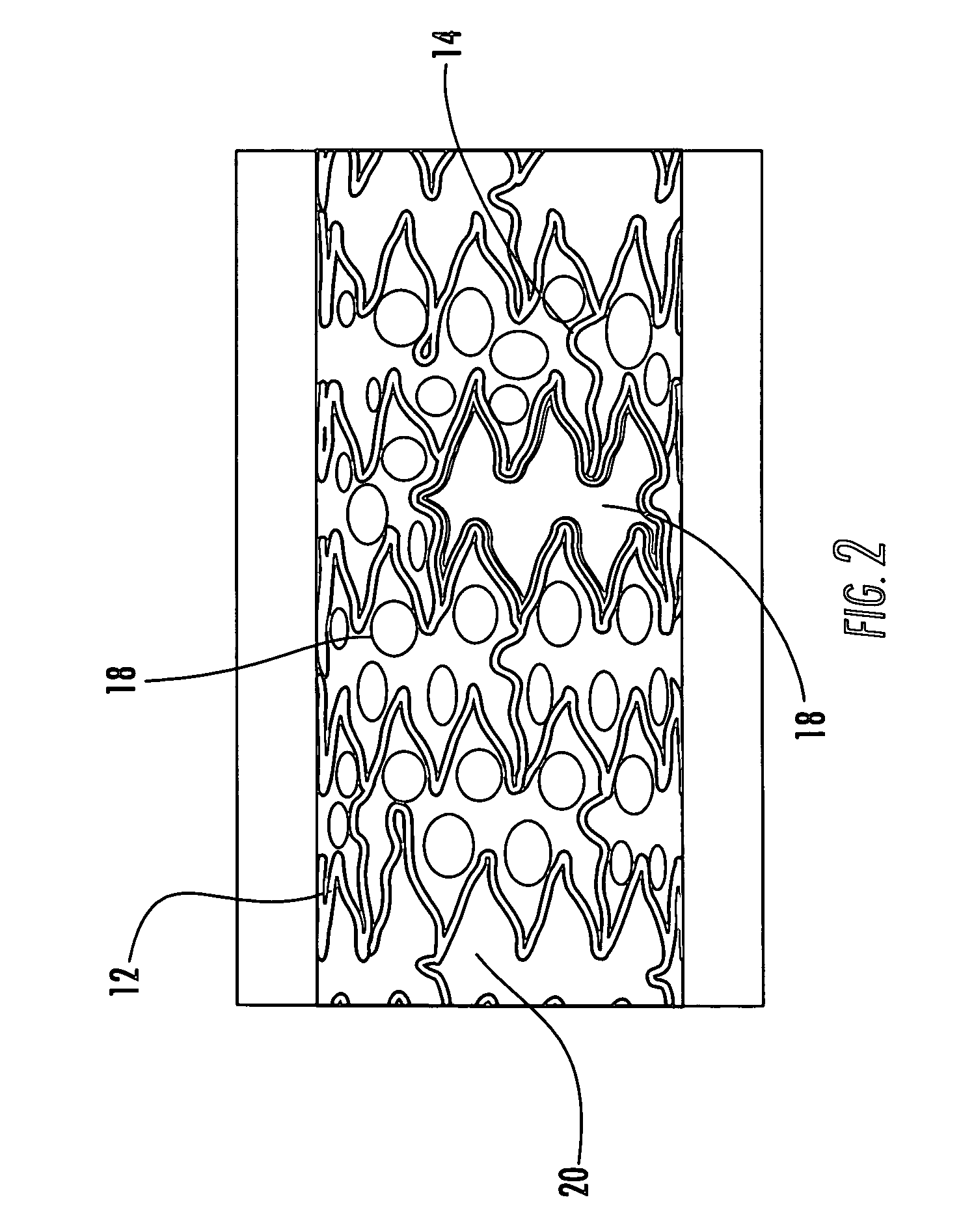 Drainage stent and associated method