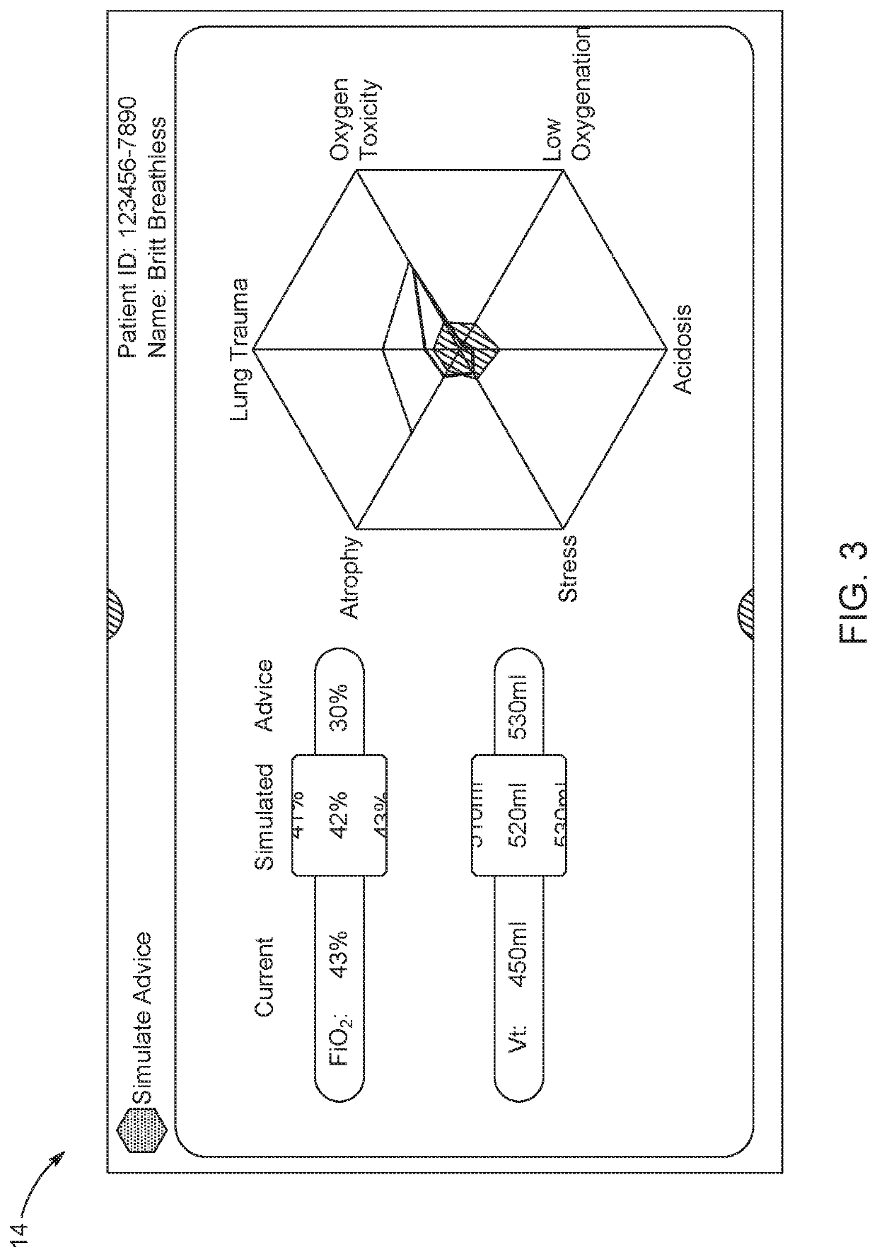Decision support system for lung ventilator settings