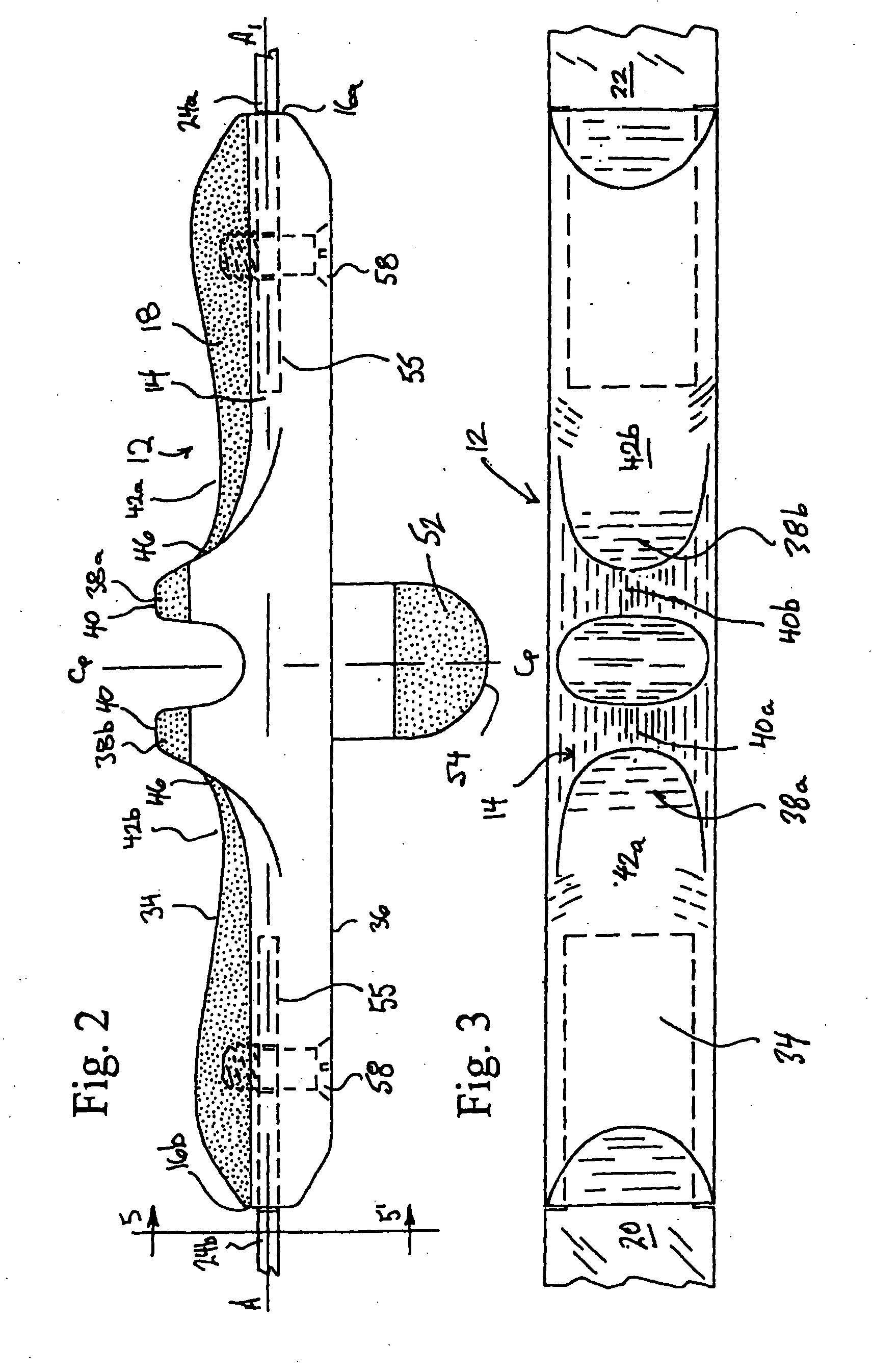 Physical Therapy Apparatus for Self-Administered Soft Tissue Manipulation