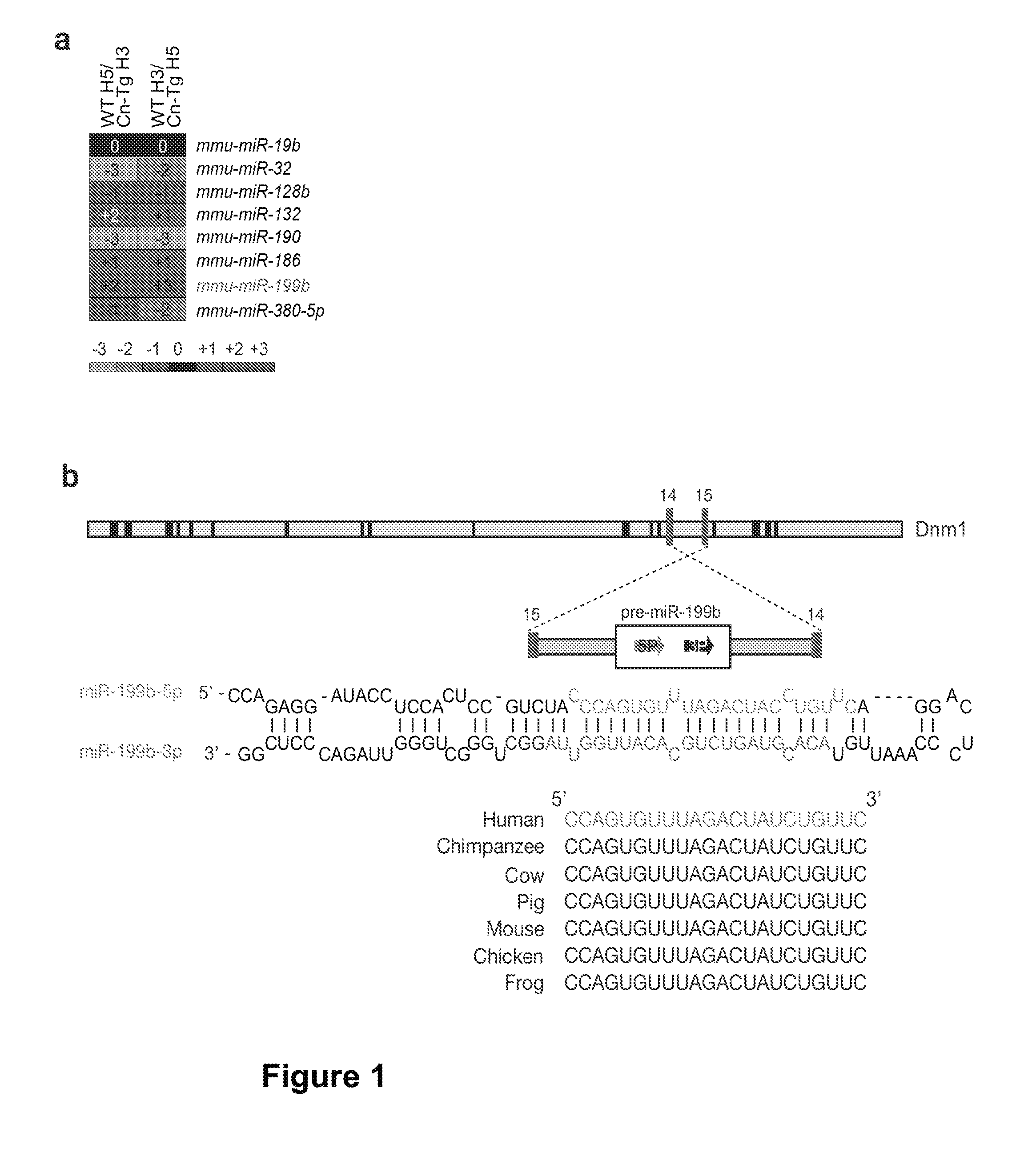 Means and methods for counteracting, delaying and/or preventing heart disease