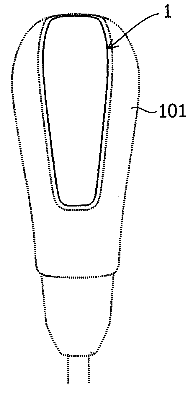 Molded plastic part