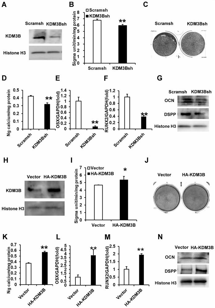 Application of KDM3B gene in mesenchymal stem cell osteogenic/odontogenic differentiation, proliferation and migration chemotaxis