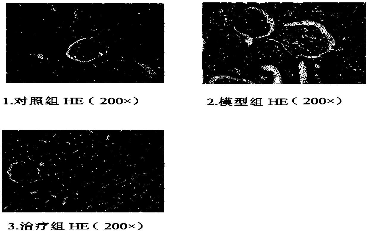 Traditional Chinese medicine composition for preventing and treating renal ischemia-reperfusion injury and preparation method thereof