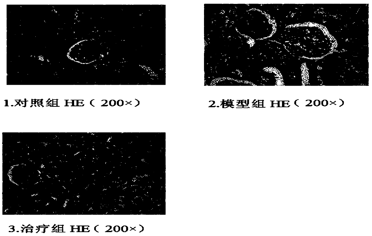 Traditional Chinese medicine composition for preventing and treating renal ischemia-reperfusion injury and preparation method thereof