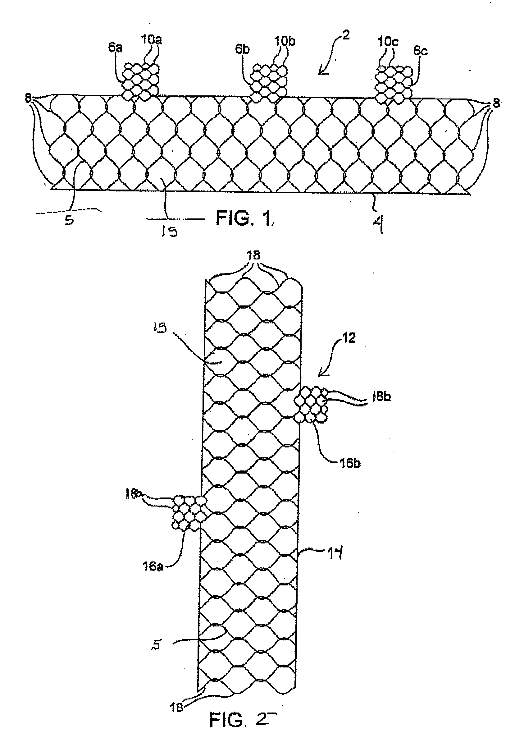 Vascular implants and methods of fabricating the same