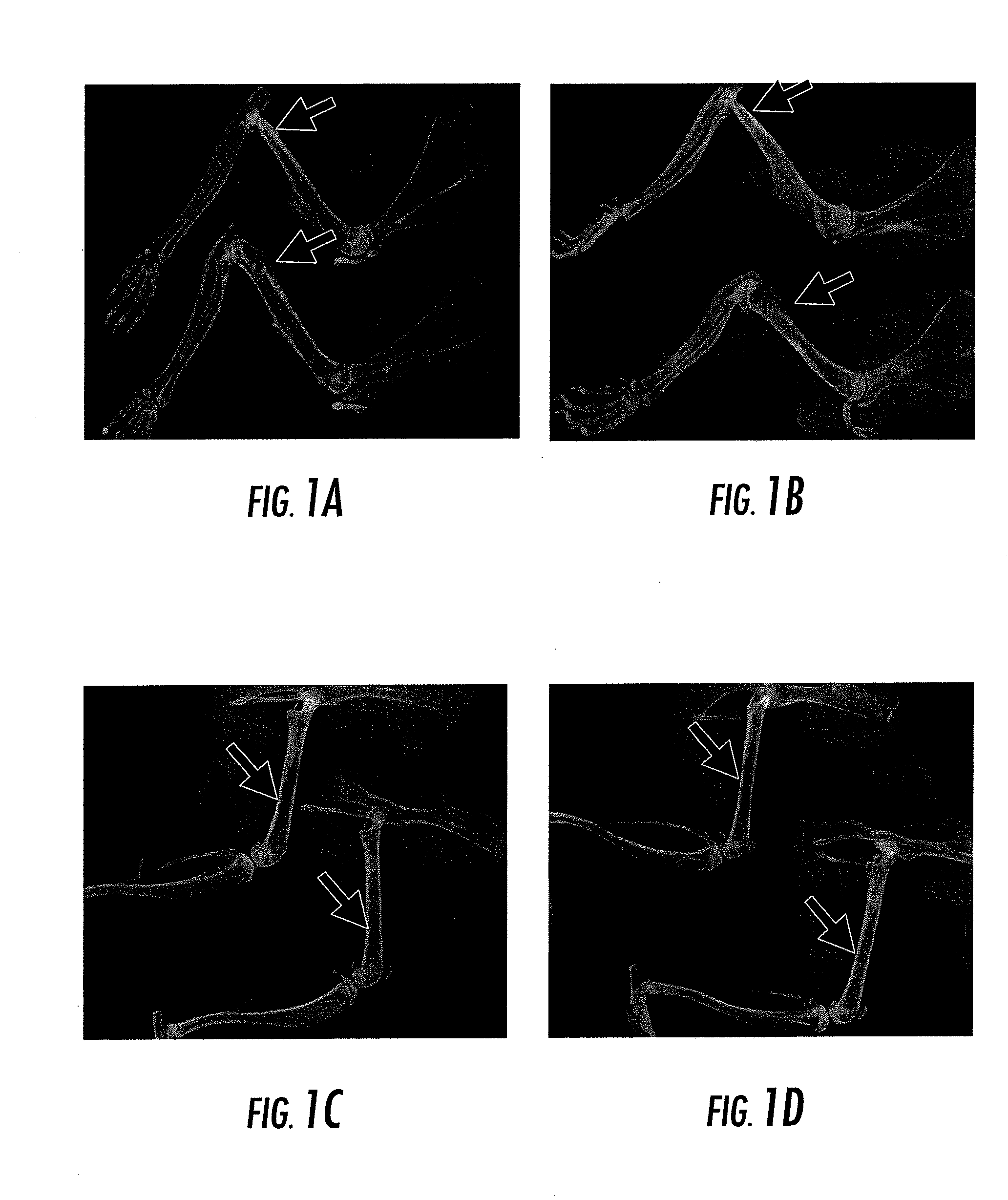 Compositions and Methods for the Treatment of Musculoskeletal Related Diseases and Disorders Using Metal Ion-Citrate Analog Complexes