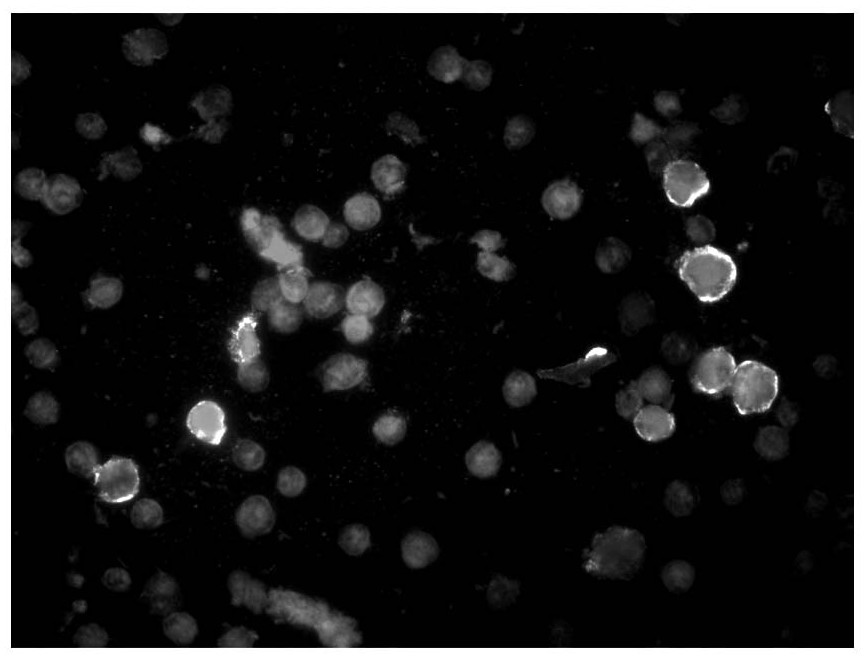 Distinguishing Method of Fluorescence Microscopy Image Result