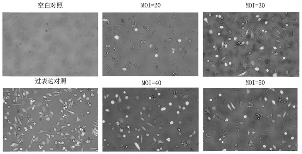 A kind of exosome containing mir-204 and its preparation method and application