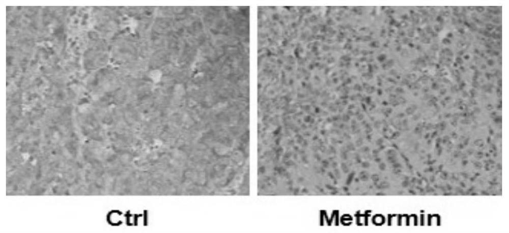 Application of pharmaceutical composition of metformin and anti-PD-1 antibody in preparation of liver cancer drugs