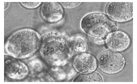 Preparation method of Bifidobacterium infantis microcapsules