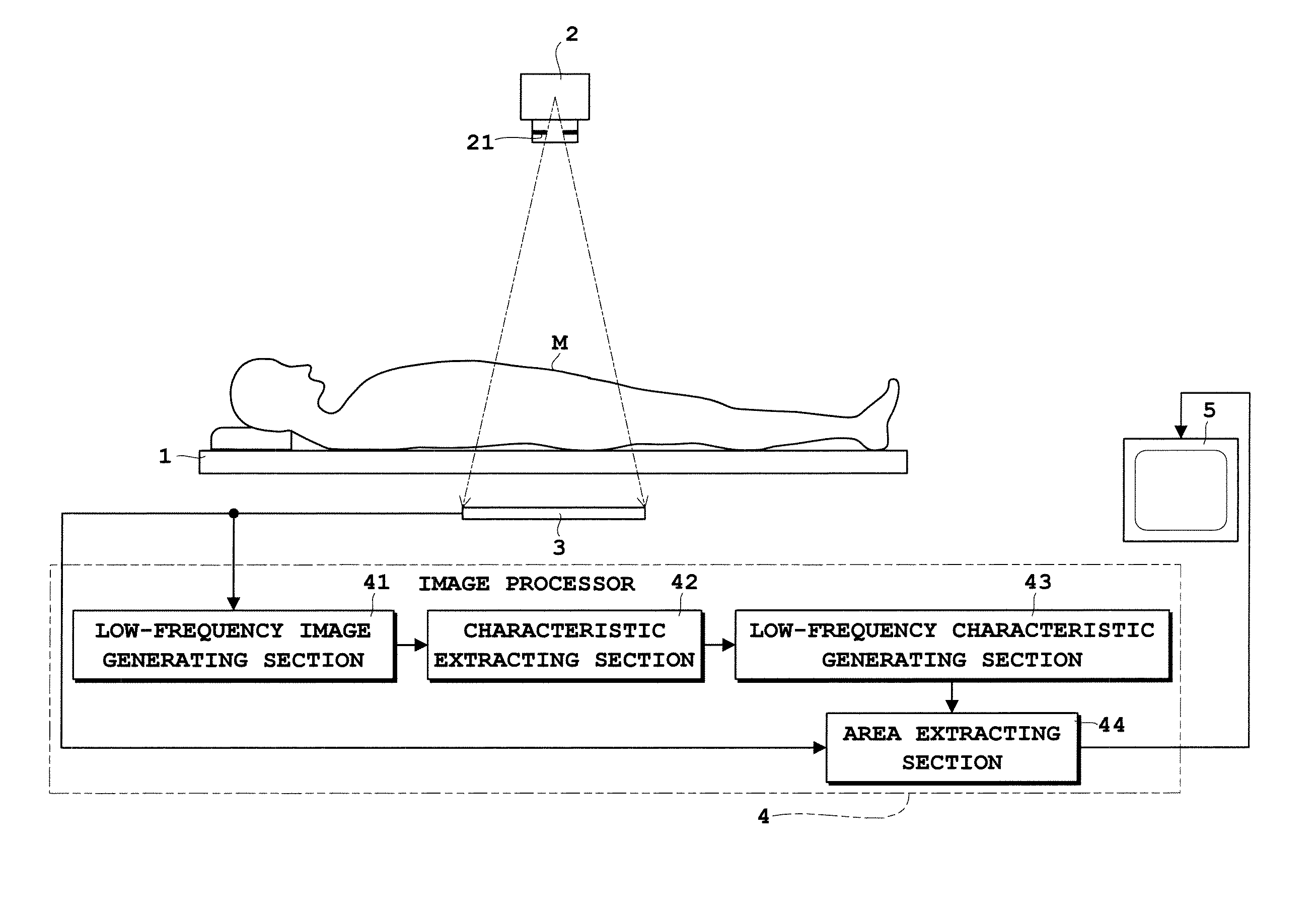 Radiographic image processing apparatus and radiographic image processing program