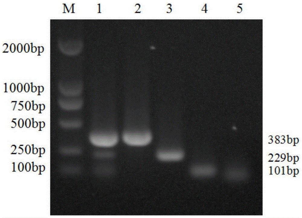 Multiplex RT-PCR detection primer for porcine delta coronavirus, porcine epidemic diarrhea virus and porcine transmissible gastroenteritis virus