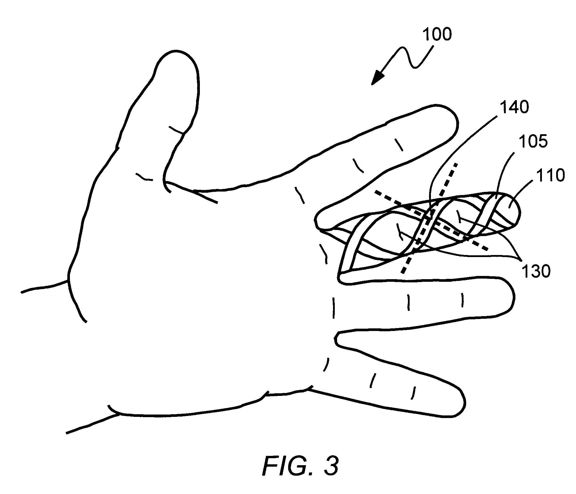 Glove reinforcement and method thereof