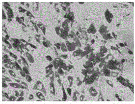 Construction method and application of hascs for overexpressing metallothionein