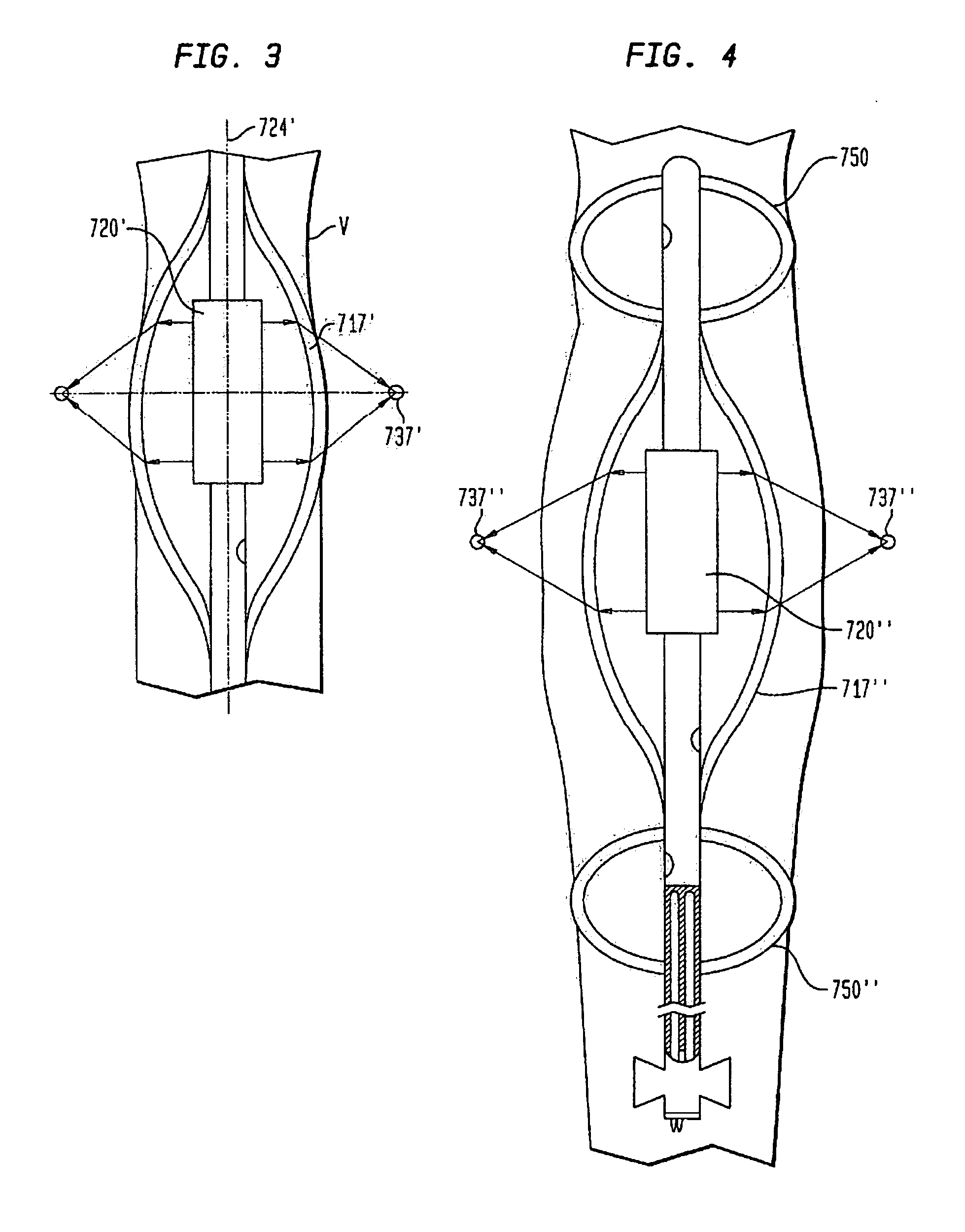 Energy application with inflatable annular lens