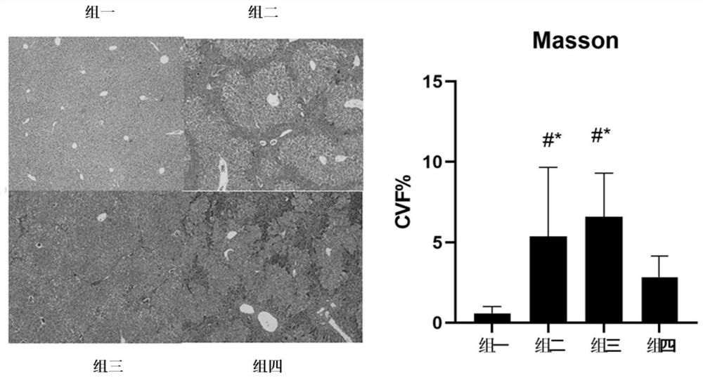 Application of lithocholic acid (LCA) in preparation of drug for relieving liver fibrosis