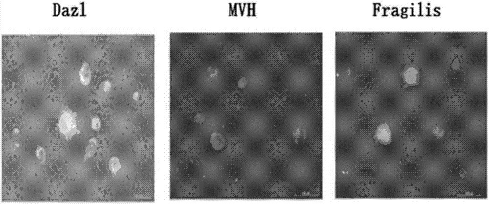 Preparation method, kit and applications of male blood-derived autologous spermatogonial stem cells