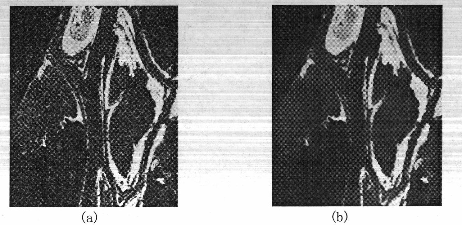 Method for detecting change of SAR images based on neighborhood similarity and double-window filtering