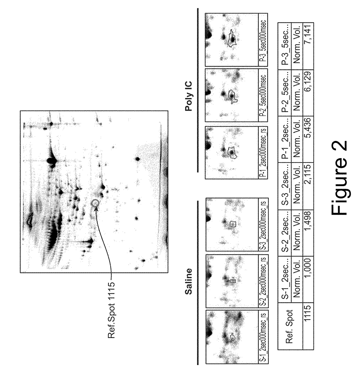 Biomarker for psychiatric and neurological disorders