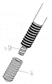Spine screw