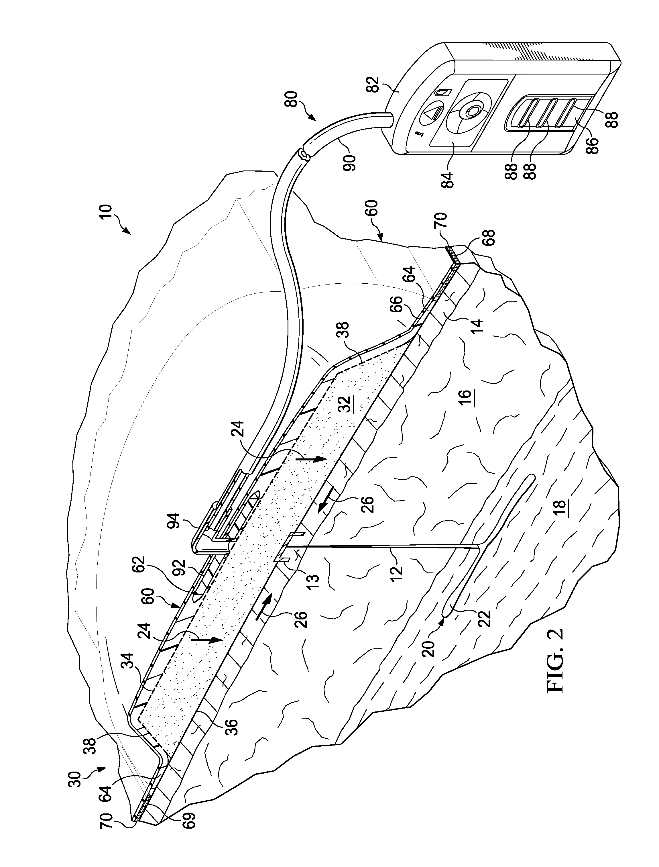 Reduced-pressure, compression systems and apparatuses for use on a curved body part