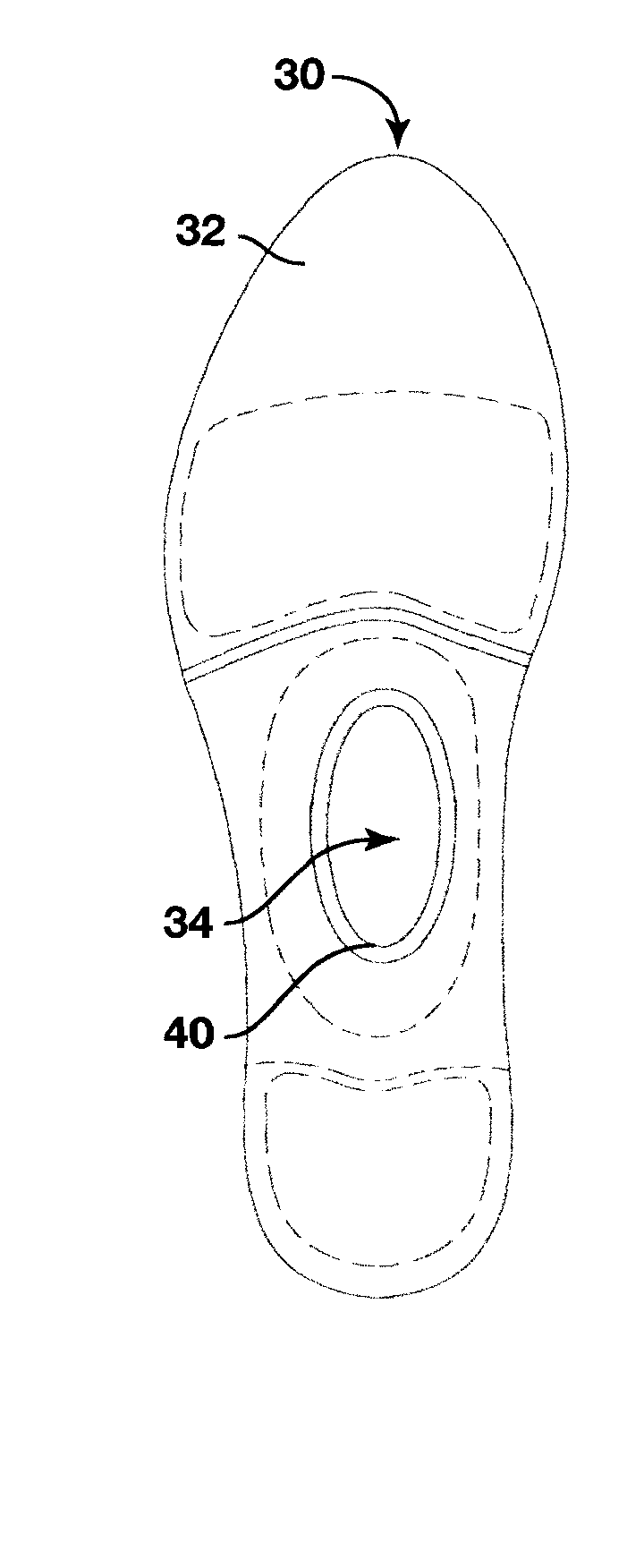 Dynamic arch stabilization and rehabilitative shoe insole device