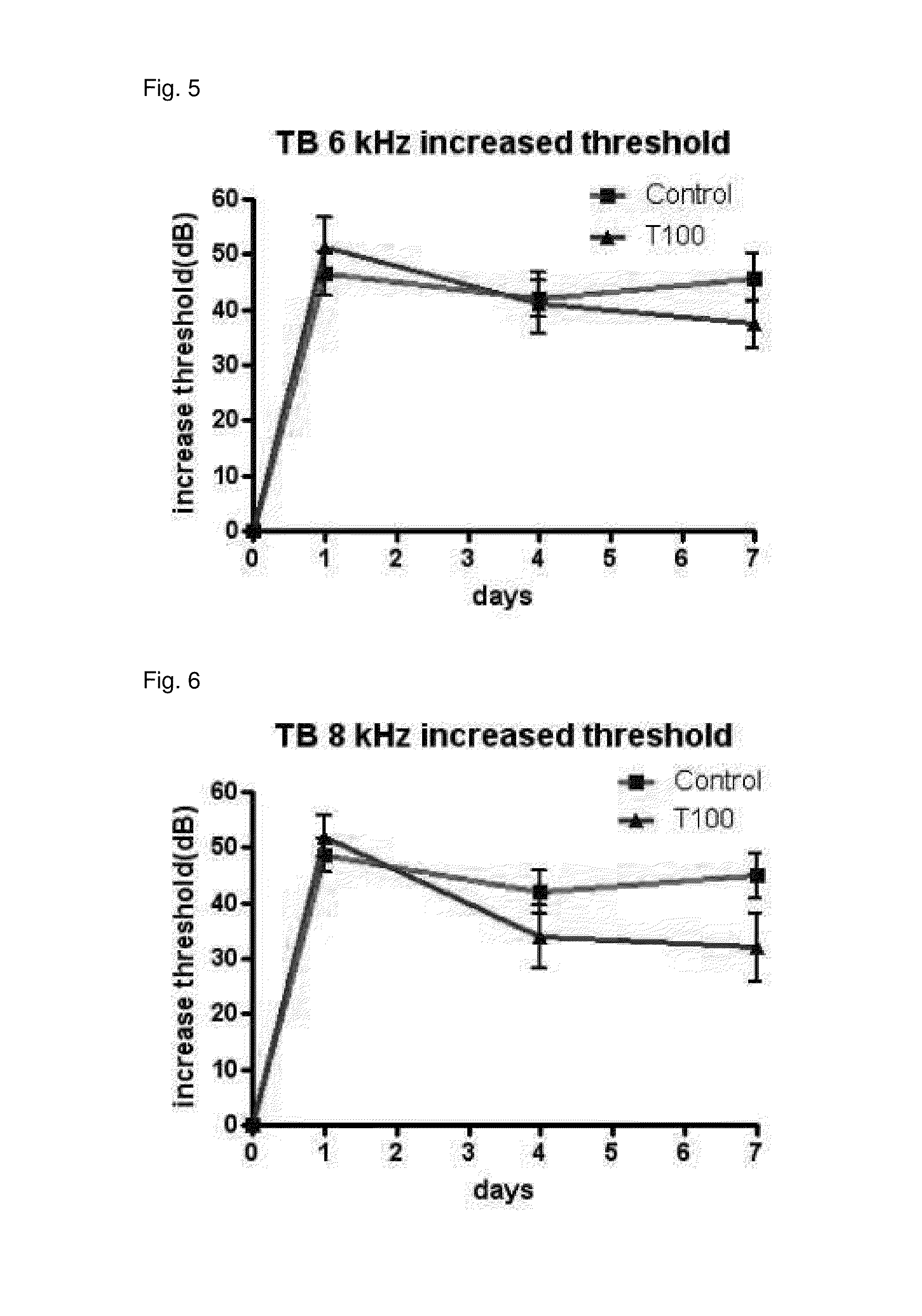 Composition for preventing or treating hearing loss