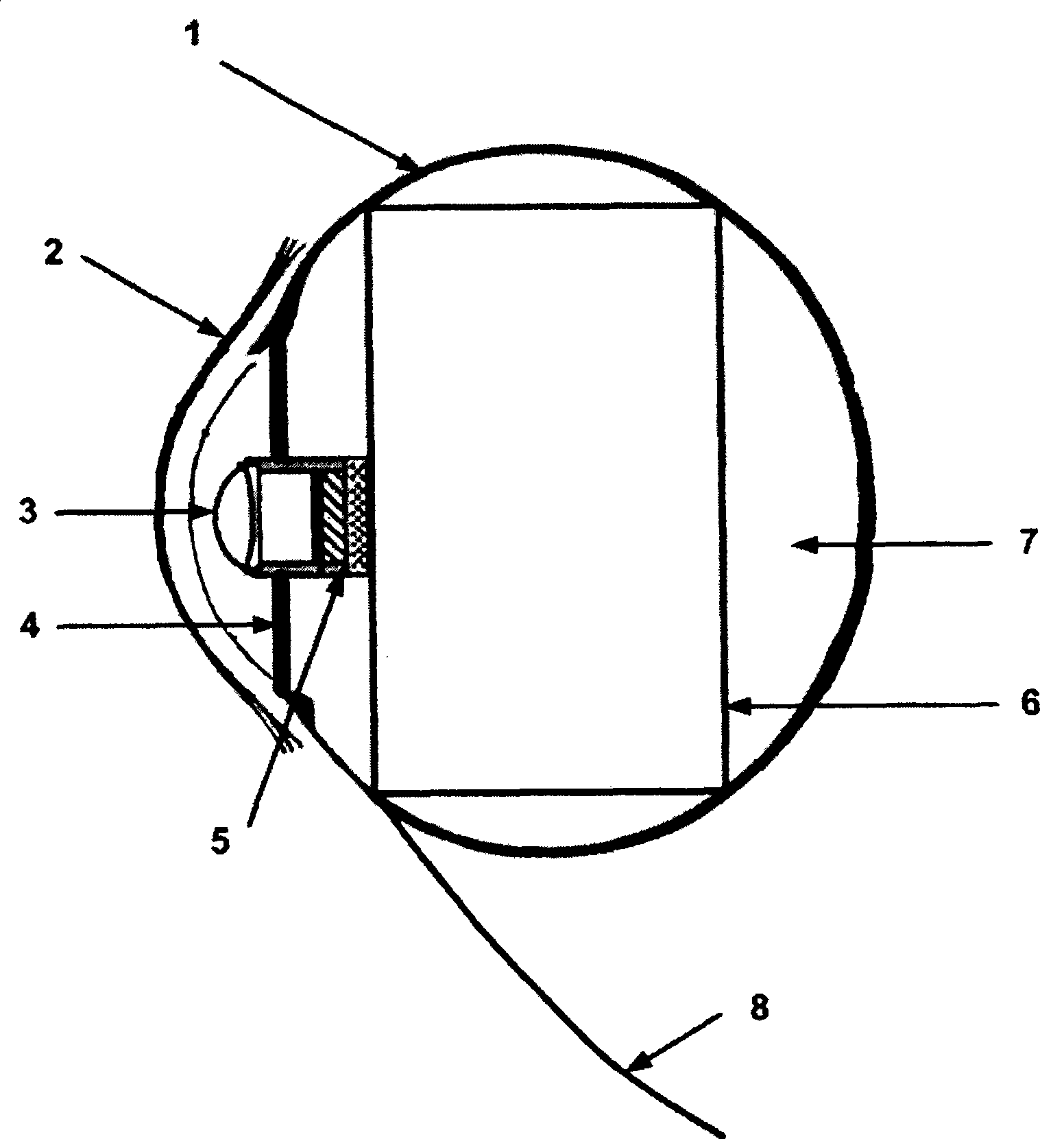 Implantable vision prosthesis