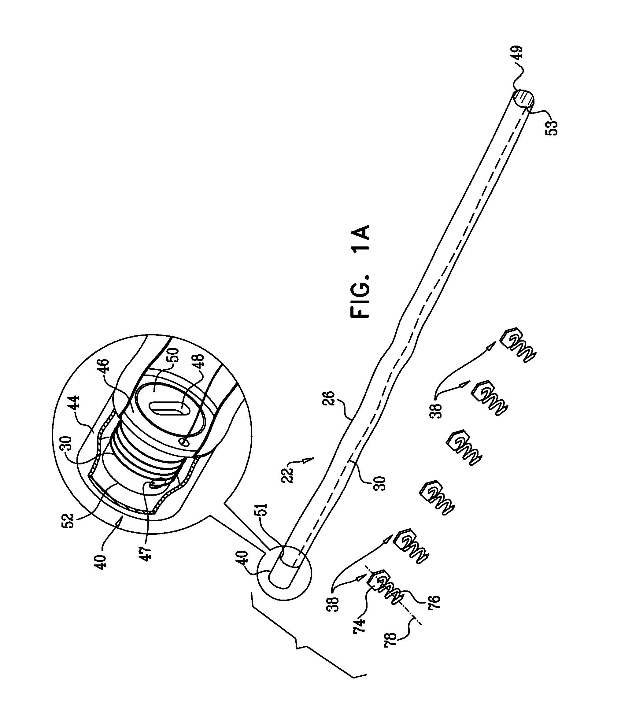 Annuloplasty ring with intra-ring anchoring