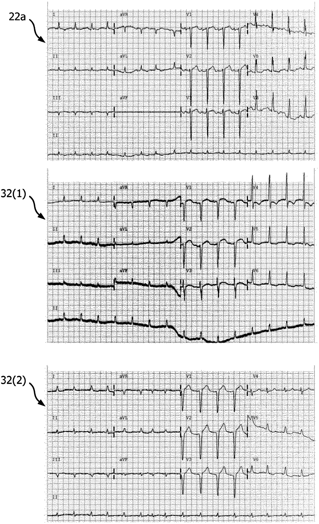 ECG training and skill enhancement