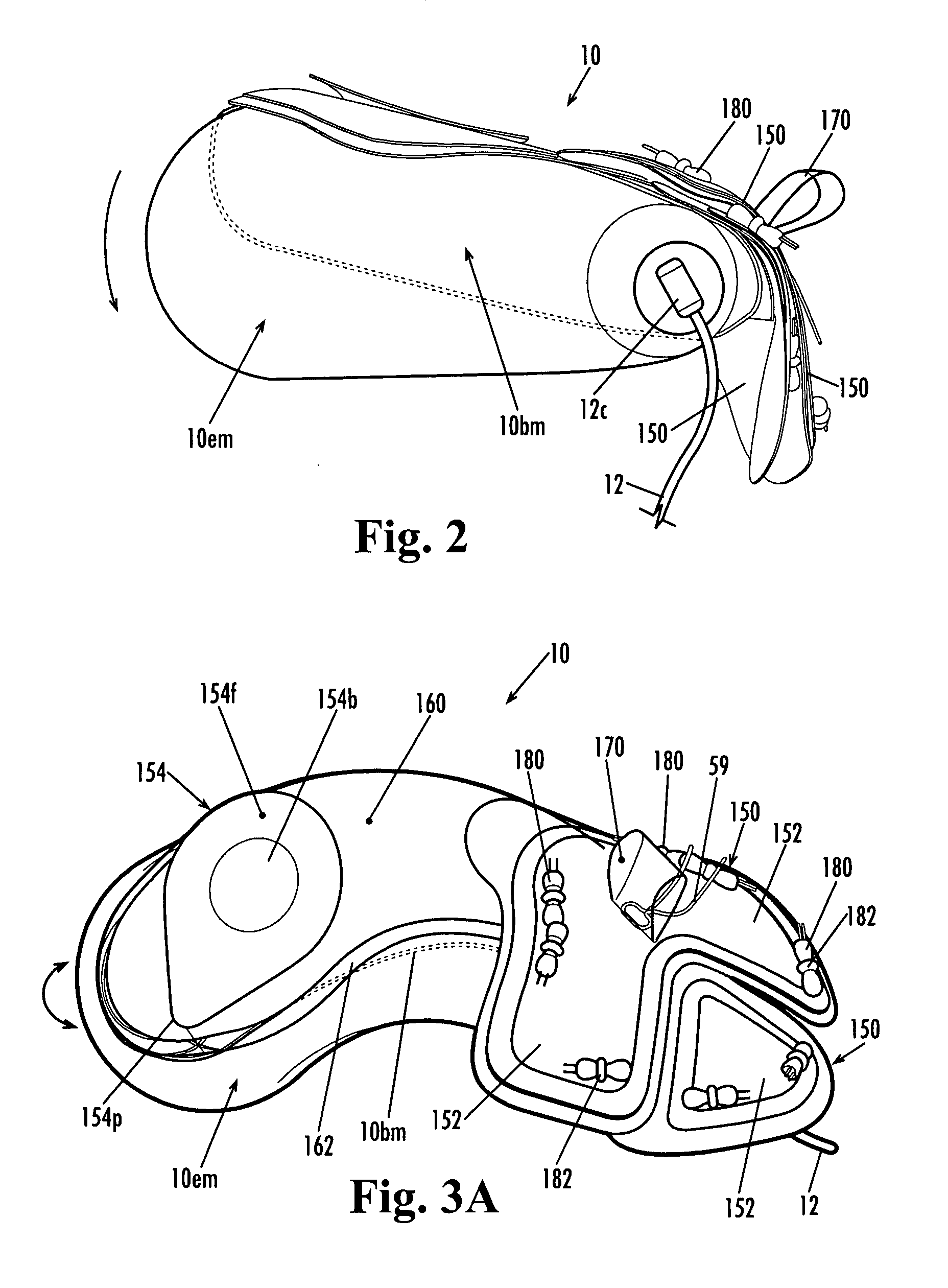 Devices and methods for treatment of obesity