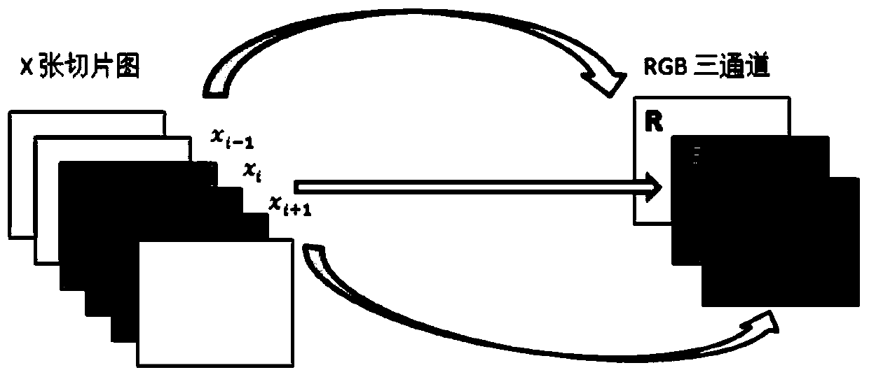 A rapid reconstruction algorithm for a PET image