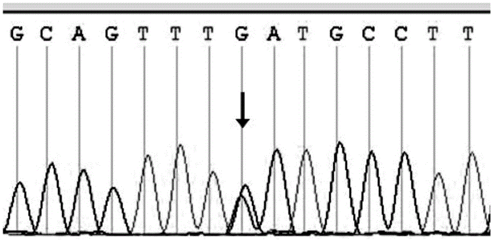 Application of abca3 gene in the preparation of congenital ccmc diagnostic products