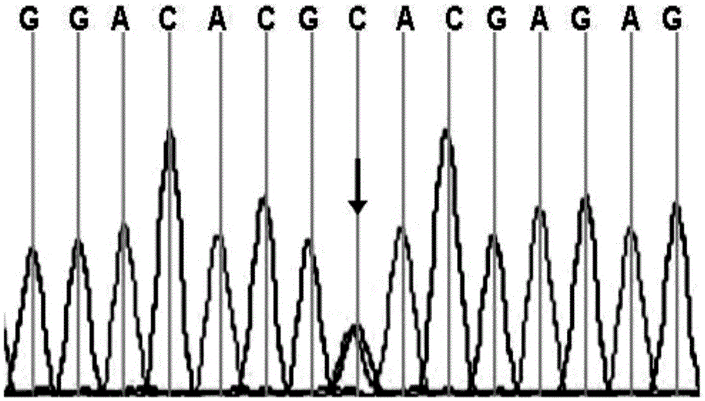 Application of abca3 gene in the preparation of congenital ccmc diagnostic products