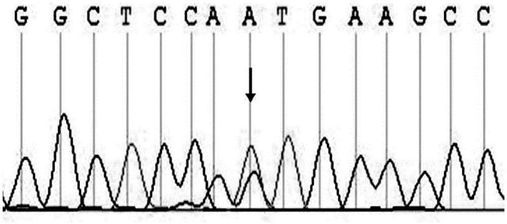 Application of abca3 gene in the preparation of congenital ccmc diagnostic products