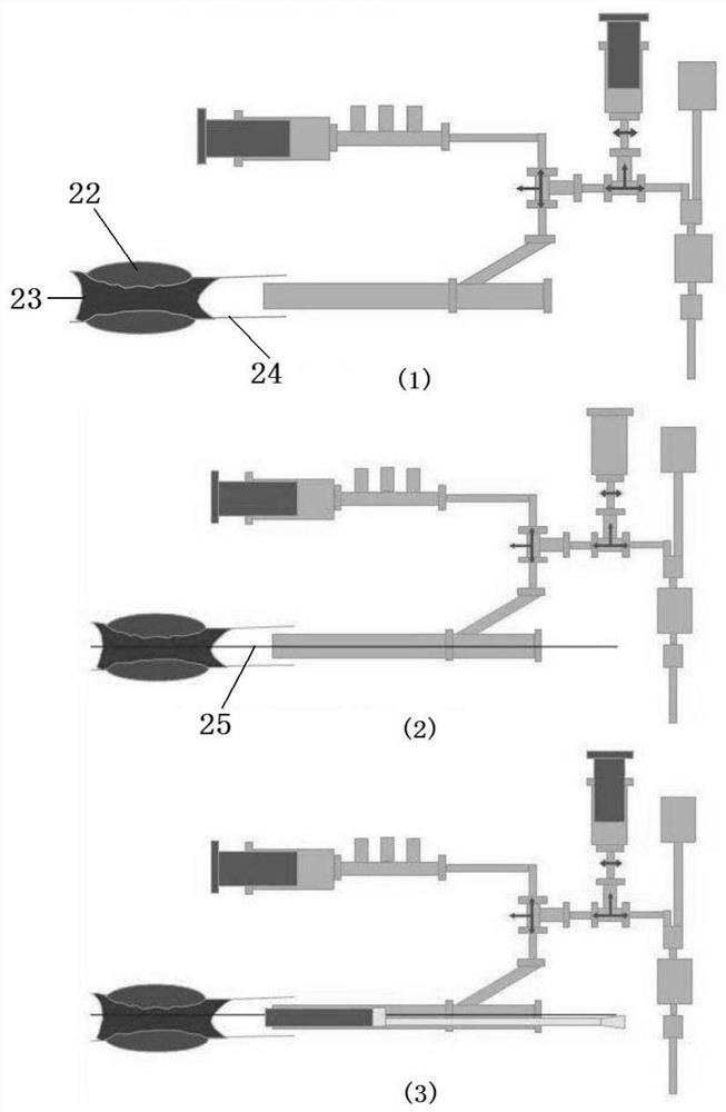 Quick exchange type large-cavity thrombus aspiration catheter and use method thereof